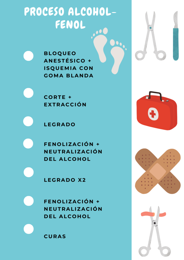 1. Bloqueo anestésico (se administra la anestesia necesaria para que el paciente no sienta dolor durante la intervención quirúrgica). 2. Isquemia con banda elástica (provocada en el miembro que se vaya a operar, interrumpiendo el riego sanguíneo de la zona, para poder realizar el proceso con el campo despejado). 3. Corte longitudinal (con dicho corte, procedemos a eliminar toda la uña sobrante que causa el problema). 4. Extracción (retirada de la uña sobrante tras el corte longitudinal). 5. Legrado (una de las partes más importantes del proceso, con el legrado se retiran todos los restos que queden y se limpia la zona para evitar infecciones y problemas posteriores, además, asegura que el trozo ungueal se ha extraído correctamente y no queda ningún sobrante ni restos). 6. Confrontación de bordes (para realizar posteriormente el fenol) 7. Fenolización (se administra el fenol para destruir las células madre que pueden regenerar el trozo ungueal sobrante, evitando así, que vuelva a nacer). 8. Neutralización del alcohol (tras el fenol) 9. Legrado (se vuelve a limpiar la zona y retirar todos los restos que puedan quedar durante la cirugía) 10. Fenolización 11. Neutralización con alcohol 12. Curas (dependiendo del paciente, se irán modificando el número e intervalos entre estas, además de los materiales utilizados en ellas).