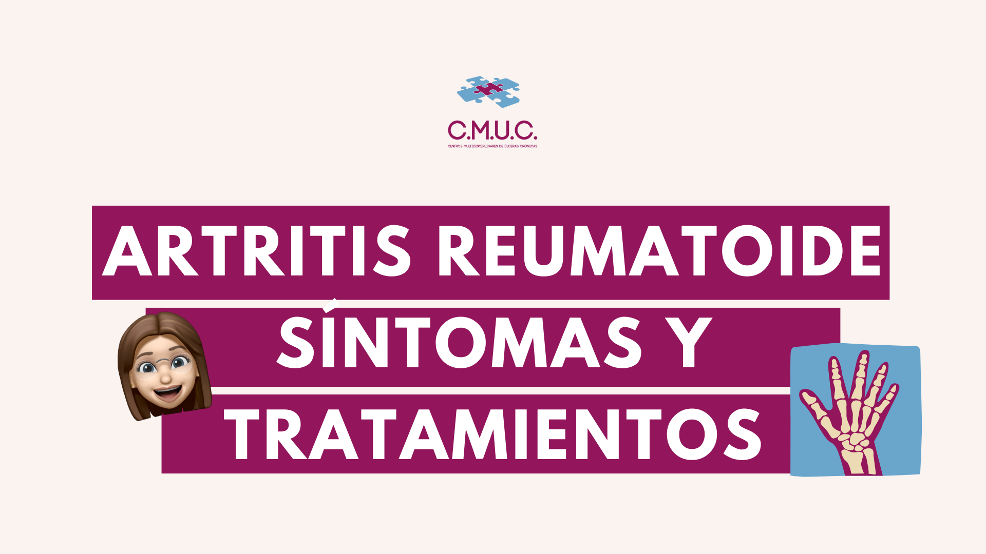 Artritis Reumatoide