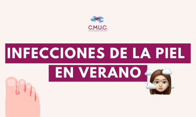 Infecciones de la piel verano