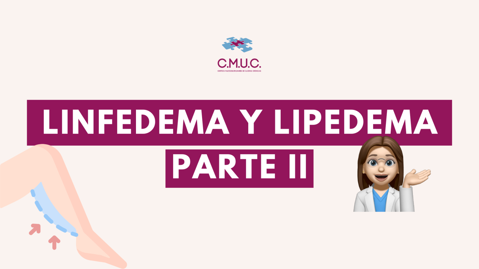 Linfedema y Lipedema: Diferencias, síntomas y tratamiento
