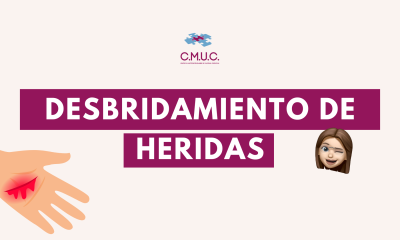 Desbridamiento