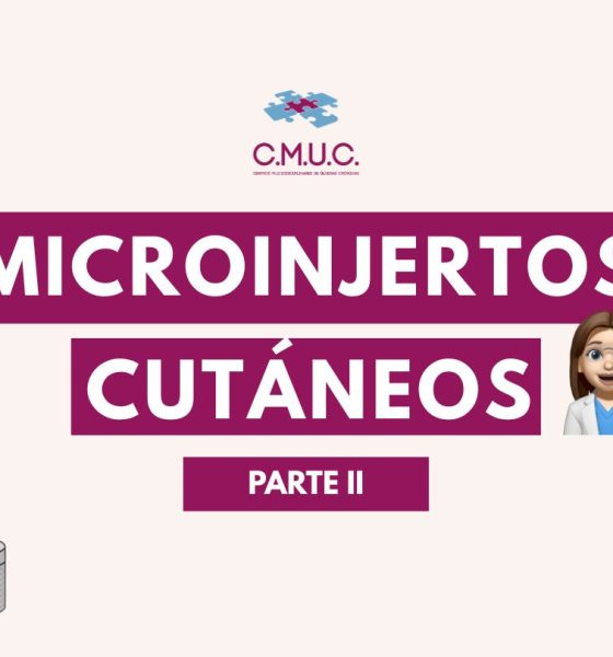 Casos clínicos con microinjertos cutáneos