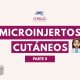 Casos clínicos con microinjertos cutáneos