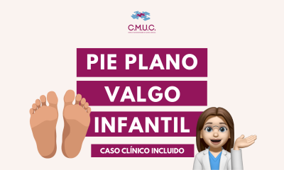 PIE PLANO VALGO