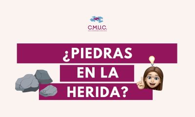 piedras en las úlceras, calcificaciones en úlceras crónicas, calcinosis cutis, calcificación distrófica, depósitos de calcio en heridas, úlceras venosas, heridas crónicas, pie diabético, cicatrización de heridas, tratamiento de úlceras