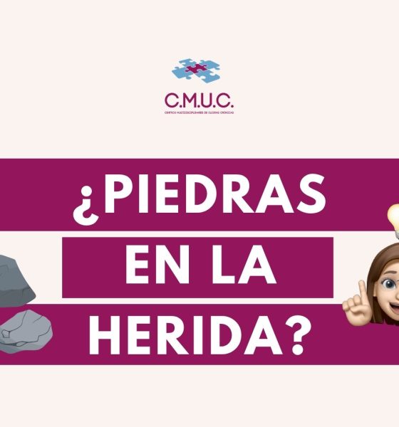 piedras en las úlceras, calcificaciones en úlceras crónicas, calcinosis cutis, calcificación distrófica, depósitos de calcio en heridas, úlceras venosas, heridas crónicas, pie diabético, cicatrización de heridas, tratamiento de úlceras
