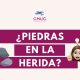 piedras en las úlceras, calcificaciones en úlceras crónicas, calcinosis cutis, calcificación distrófica, depósitos de calcio en heridas, úlceras venosas, heridas crónicas, pie diabético, cicatrización de heridas, tratamiento de úlceras